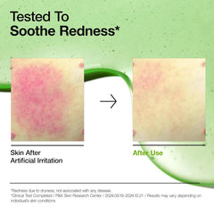 Azelaic Acid 10 Hyaluron Redness Soothing Serum