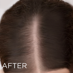 LED Intensive Scalp Stimulating Brush