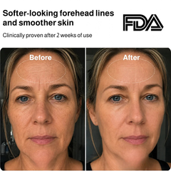 Laser Light Therapy Face Mask