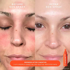 SOS Facial Rescue Spray