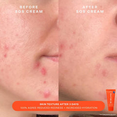 SOS Facial Rescue Spray