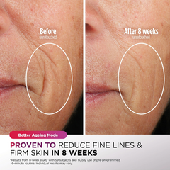 CryoGlow Under-Eye Cooling & LED Anti-Ageing & Blemish Repair Mask