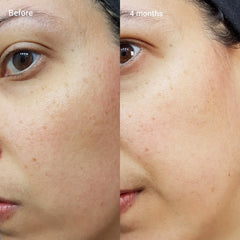 Retinol 0.5% in Squalane - 30ml