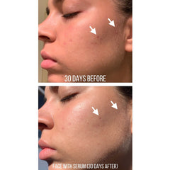 Niacinamide 10% + Zinc 1%